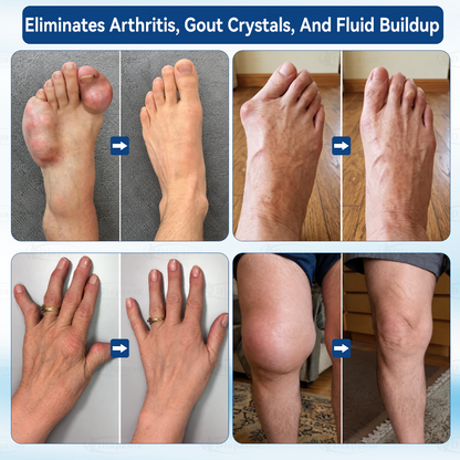 Methylene Blue Gummies.Support Arthritis.MS.Stroke.Neuropathy.Gout.Move Easier. Feel Lighter. Live Freer✅️Sugar-free💎-Save 40%Today